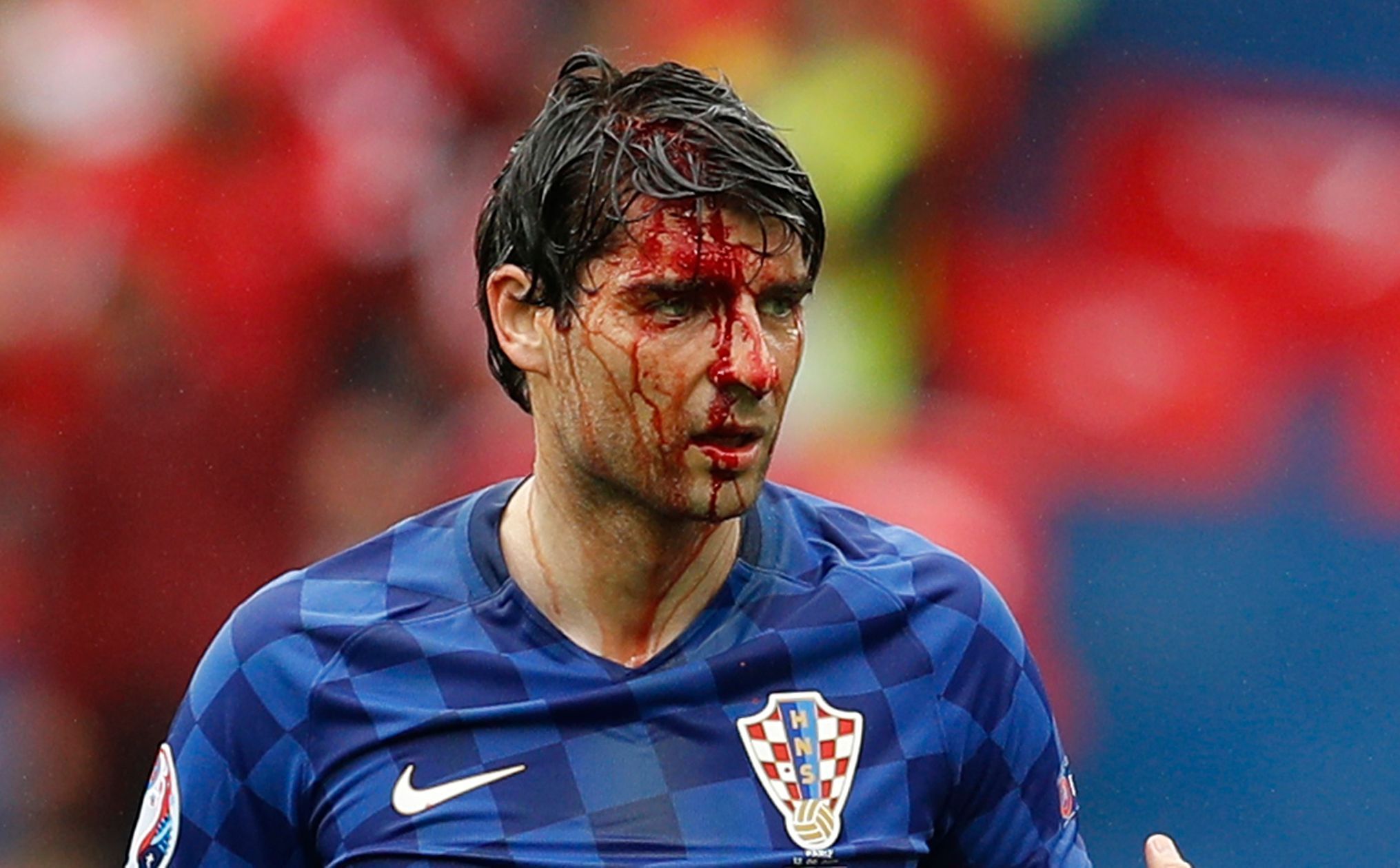 Euro 2016: Turecko-Chorvatsko: zraněný Vedran Čorluka