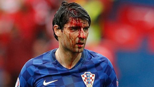 Euro 2016: Turecko-Chorvatsko: zraněný Vedran Čorluka