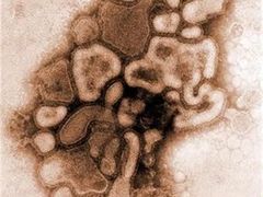 Virus (A)H1N1 - jde o jednu z prvních mutací zachycenou už v roce 1976