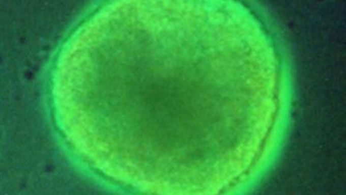 Výzkum kmenových buněk zaznamenává další kladné body