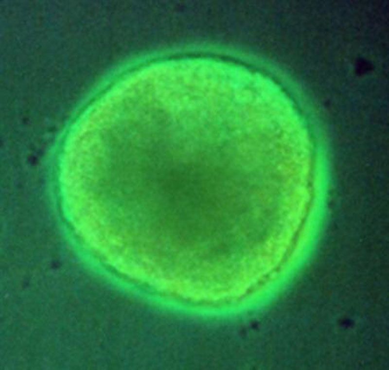 Kmenová buňka - ilustrační foto