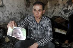 Matka upáleného palestinského chlapce podlehla svým zraněním
