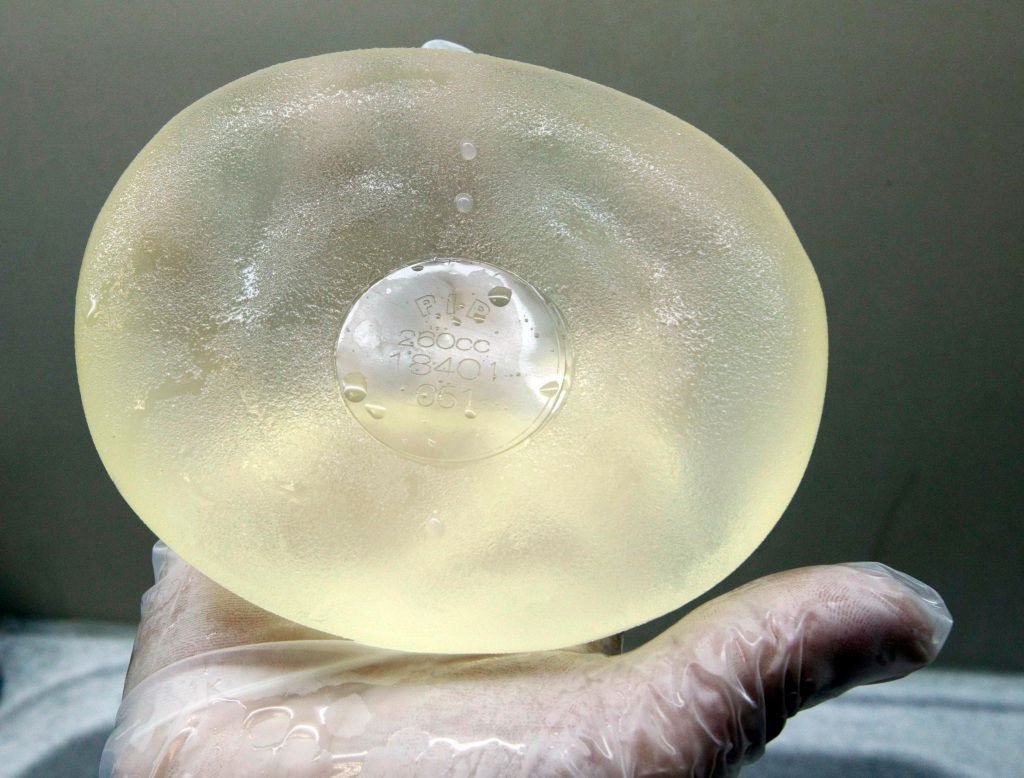 Lékaři vyjímají defektní silikonové prsní implantáty společnosti PIP