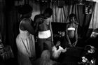 V Kamerunu žehlí dívkám prsa, aby nerostla. I tento příběh byl nominovaný na World Press Photo