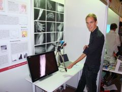 Steffen Strobel ukazuje, jak se na obrazovce objeví jeho paže se znázorněnými krevními cévami.