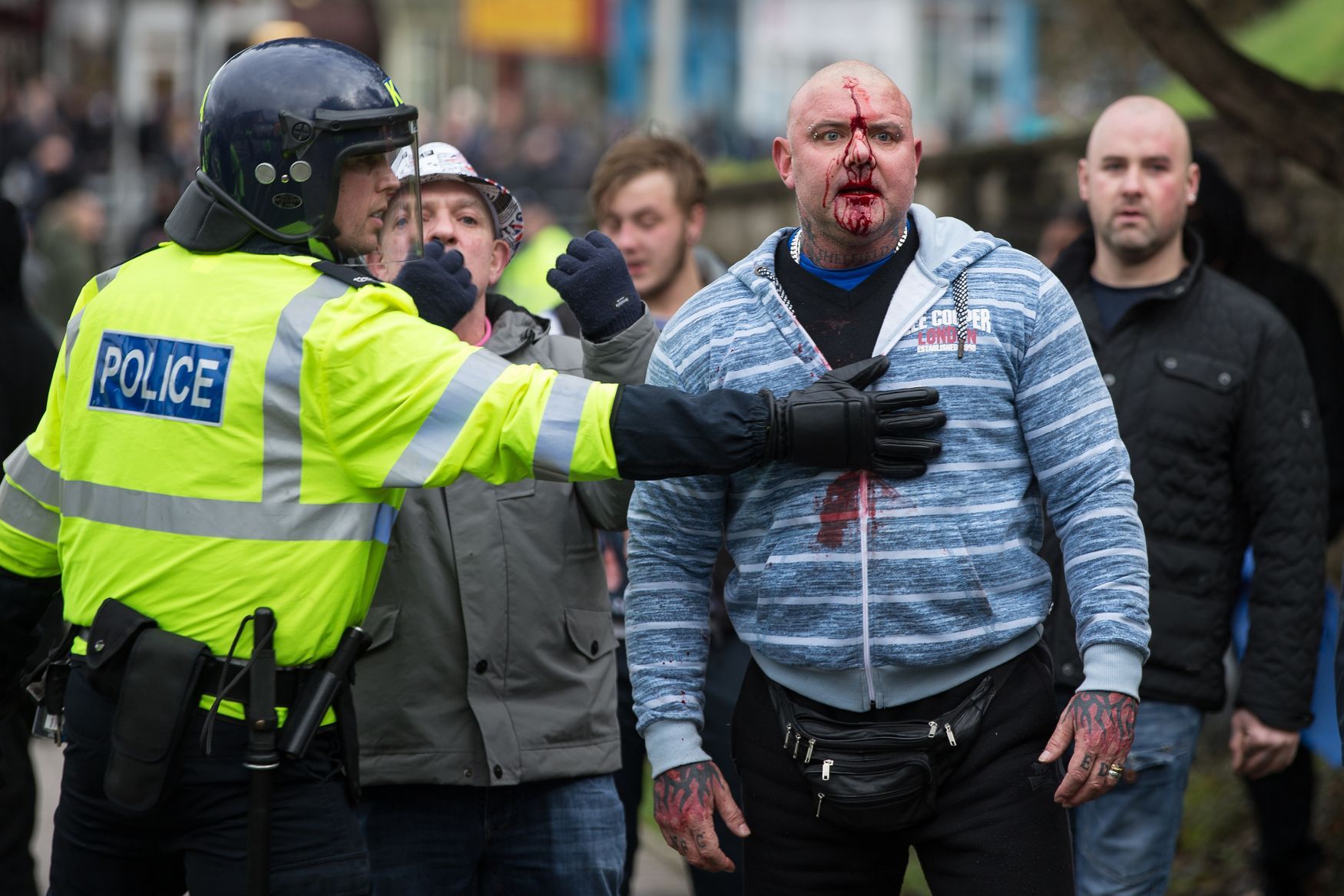Dover násilí na protiuprchlické demonstraci