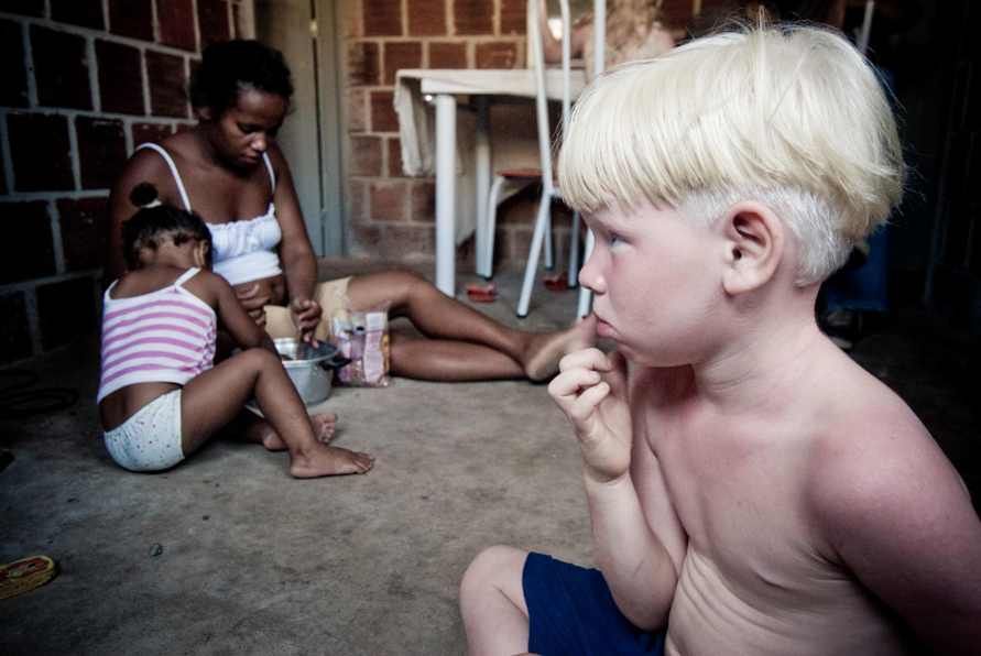 V černošské rodině se narodili tři albíni