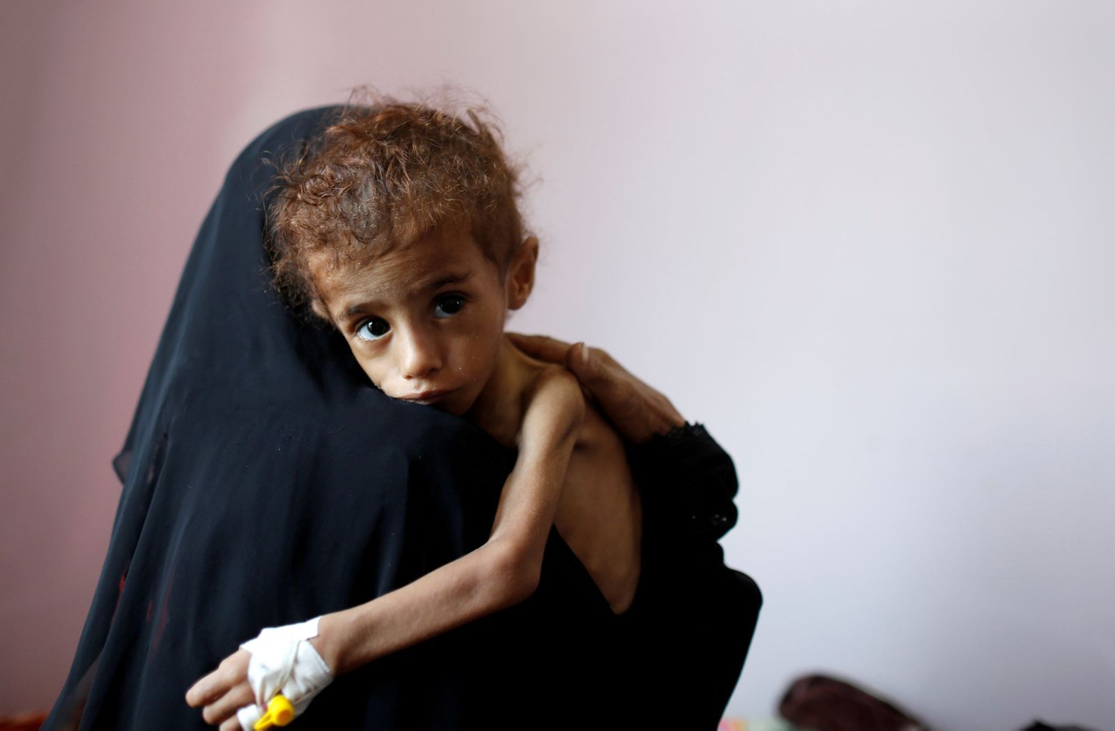 Hladomor v Jemenu