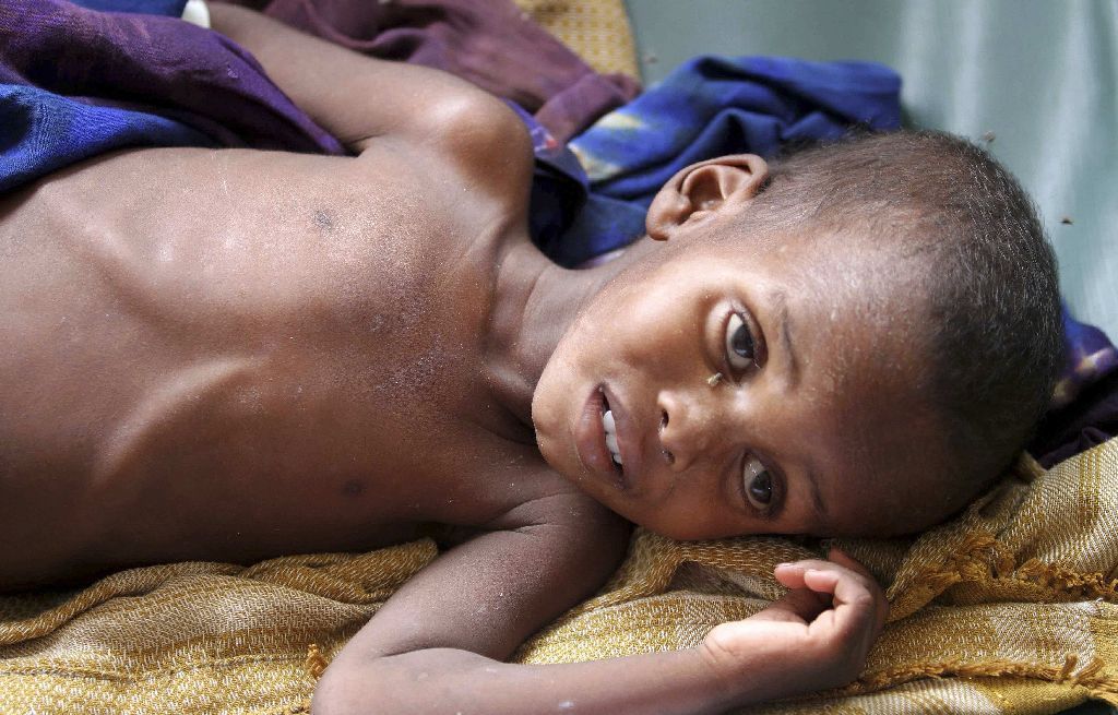 Somálsko - hladomor
