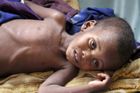 OSN: V Somálsku hrozí 60 000 dětí smrt hladem, 40 procent populace potřebuje humanitární pomoc