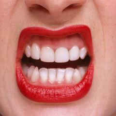 Bílé zuby