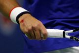 Novak Djokovič musel cestou k druhému triumfu na US Open přetrpět krvavé zranění na pravé ruce...