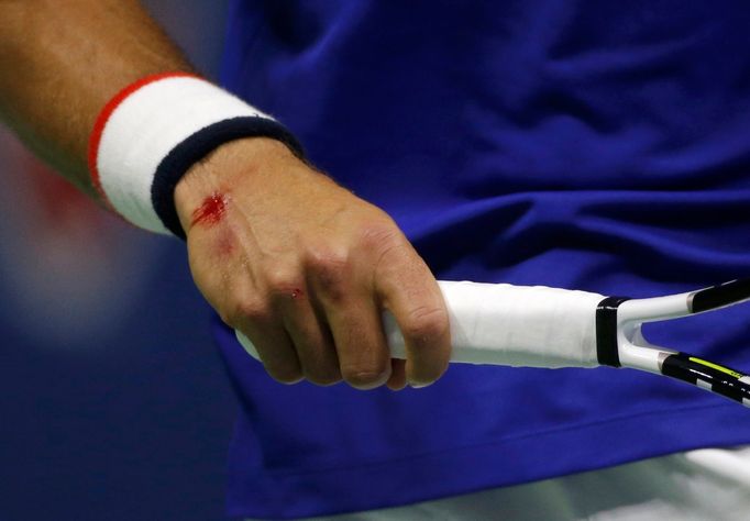 US Open 2015, finále: Novak Djokovič