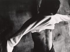 Hibakuša Tomitaro Shimotani, Nagasaki, 1961, Shomei Tomatsu