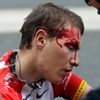 Tour de France 2011: zranění Brajkovič