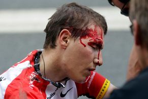 FOTO Tour de France 2011: trápení Contadora, krvavé nehody