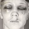 Hrozivá zranění v boxerské historii (Billy Collins Jr.)