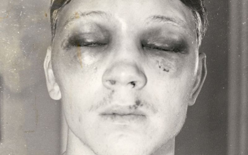 Hrozivá zranění v boxerské historii (Billy Collins Jr.)