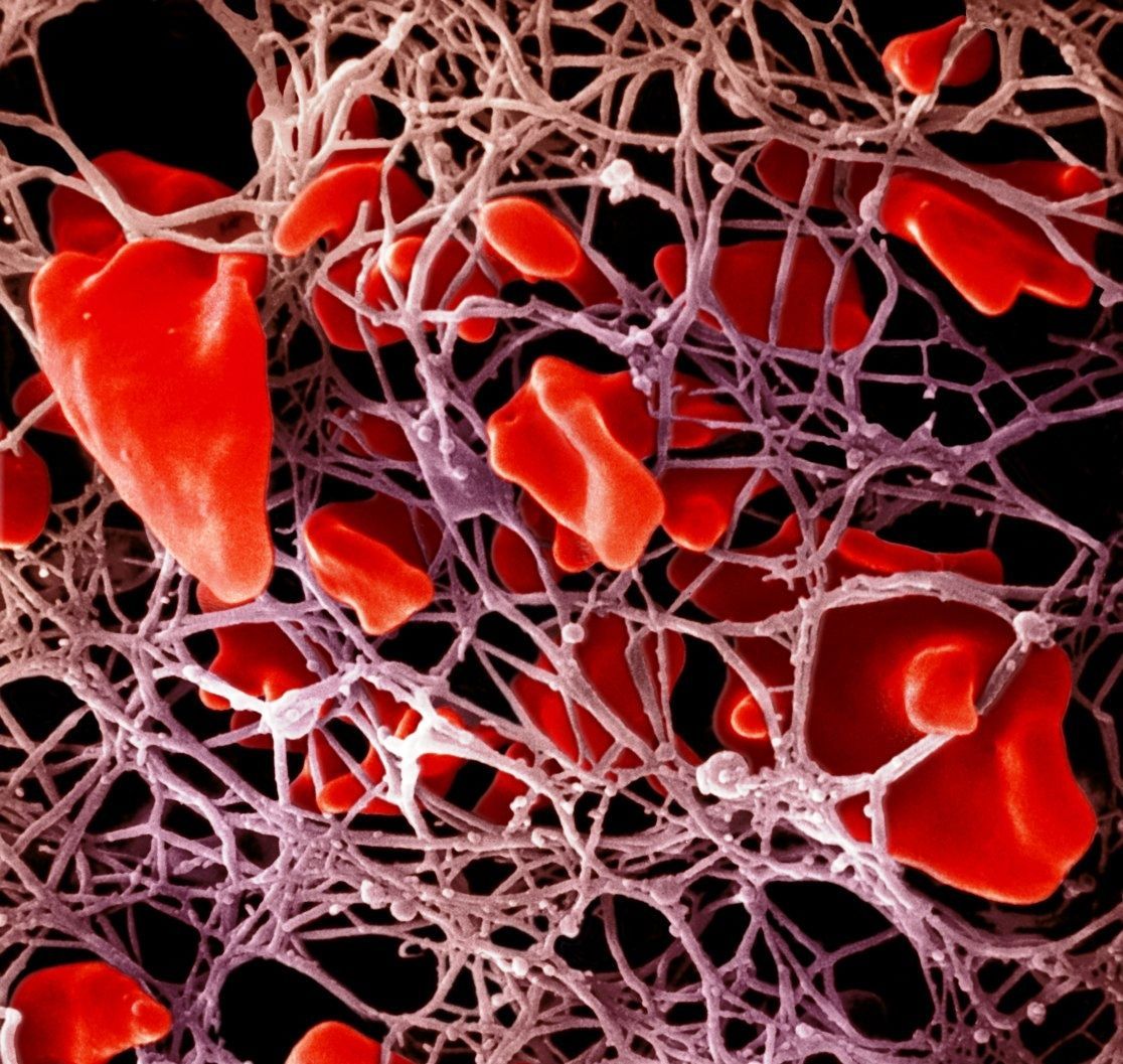 Tělo - shluk krevních sraženin kolem červených krvinek