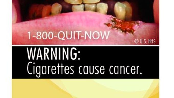 Černé zuby, černé plíce, smrt. Kuřte a uvidíte, říká nová kampaň. Tabákové firmy se hodlají bránit.