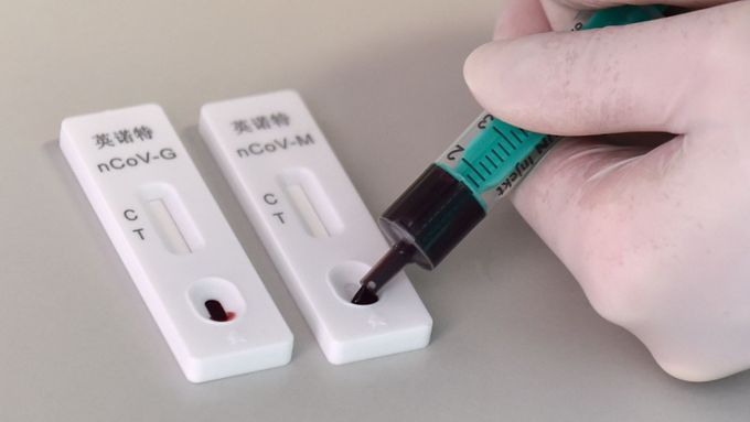 Nemocnice Tomáše Bati ve Zlíně začala 25. března 2020 využívat rychlotesty na nový typ koronaviru.