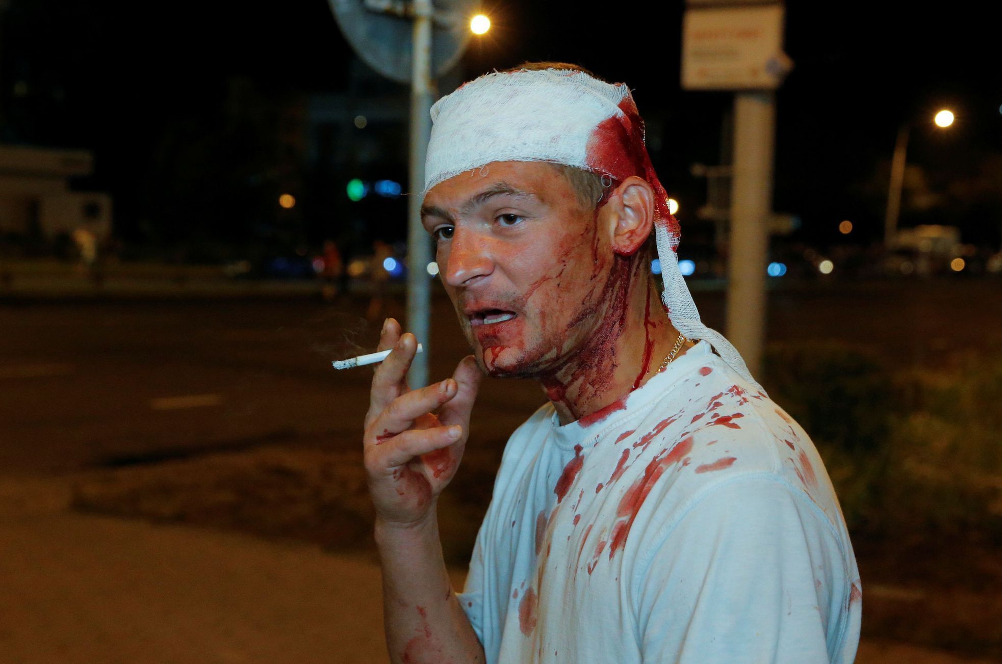 Muž zraněný na demonstraci v Minsku.