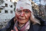 Pohled do zkrvavené tváře ženy, která byla zraněna při ruském ostřelování nedaleko Charkova na Ukrajině.