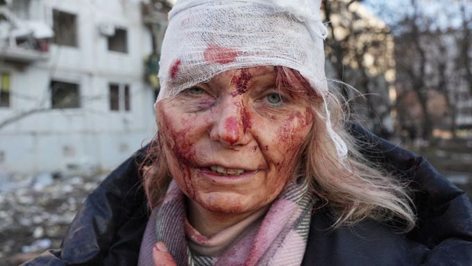 Pohled do zkrvavené tváře ženy, která byla zraněna při ruském ostřelování nedaleko Charkova na Ukrajině (24. 2. 2022)