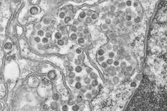 Obětí koronaviru MERS je už 126, hlásí Saúdská Arábie