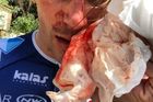 Francouzského cyklistu při tréninku zbili a pořezali