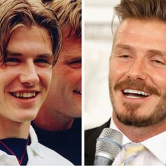 David Beckham zuby