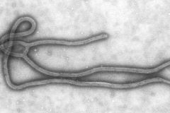 Virus Ebola-Reston se možná přenesl z prasat na lidi