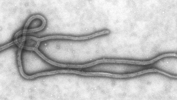 Virus Eboly, jak jej na snímku pořízeném pomocí elektronového mikroskopu zachytili pracovníci amerického Střediska pro kontrolu a prevenci nemocí (CDC)