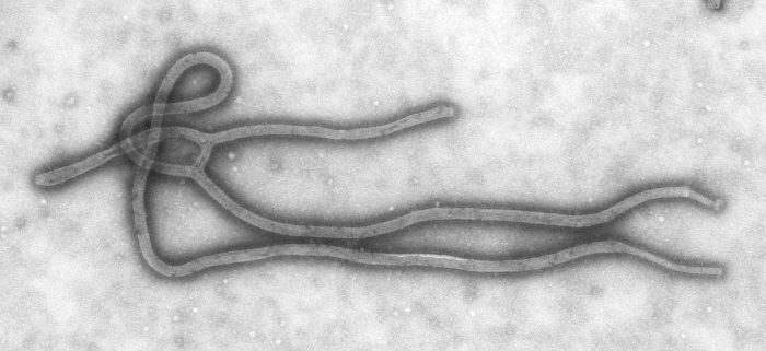 Virus Eboly