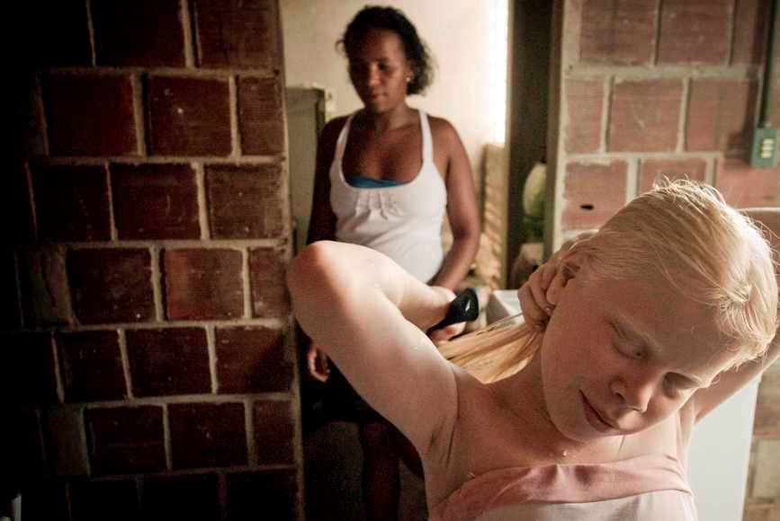 V černošské rodině se narodili tři albíni