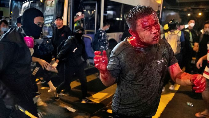 Snímky z loňských protestů v Hongkongu přinesly fotoreportérovi agentury Reuters prestižní Pulitzerovu cenu. 4. 5. 2020
