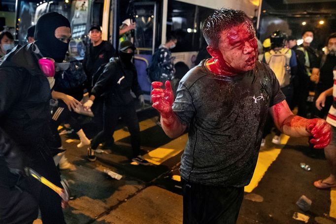 Snímky z loňských protestů v Hongkongu přinesly fotoreportérovi agentury Reuters prestižní Pulitzerovu cenu. 4. 5. 2020