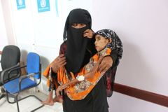 Zoufalé děti Jemenu: Dvanáctiletá dívka váží jako kojenec, bez pomoci by nepřežila