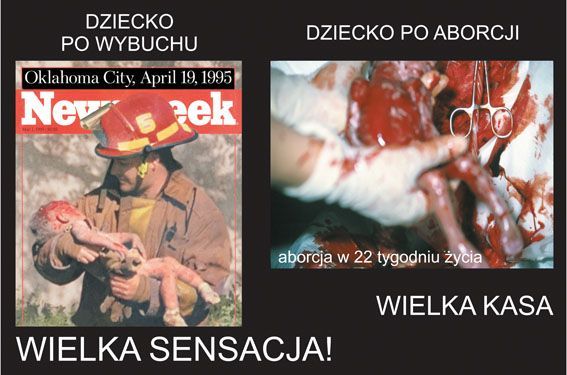 Vyber život - výstava - potrat