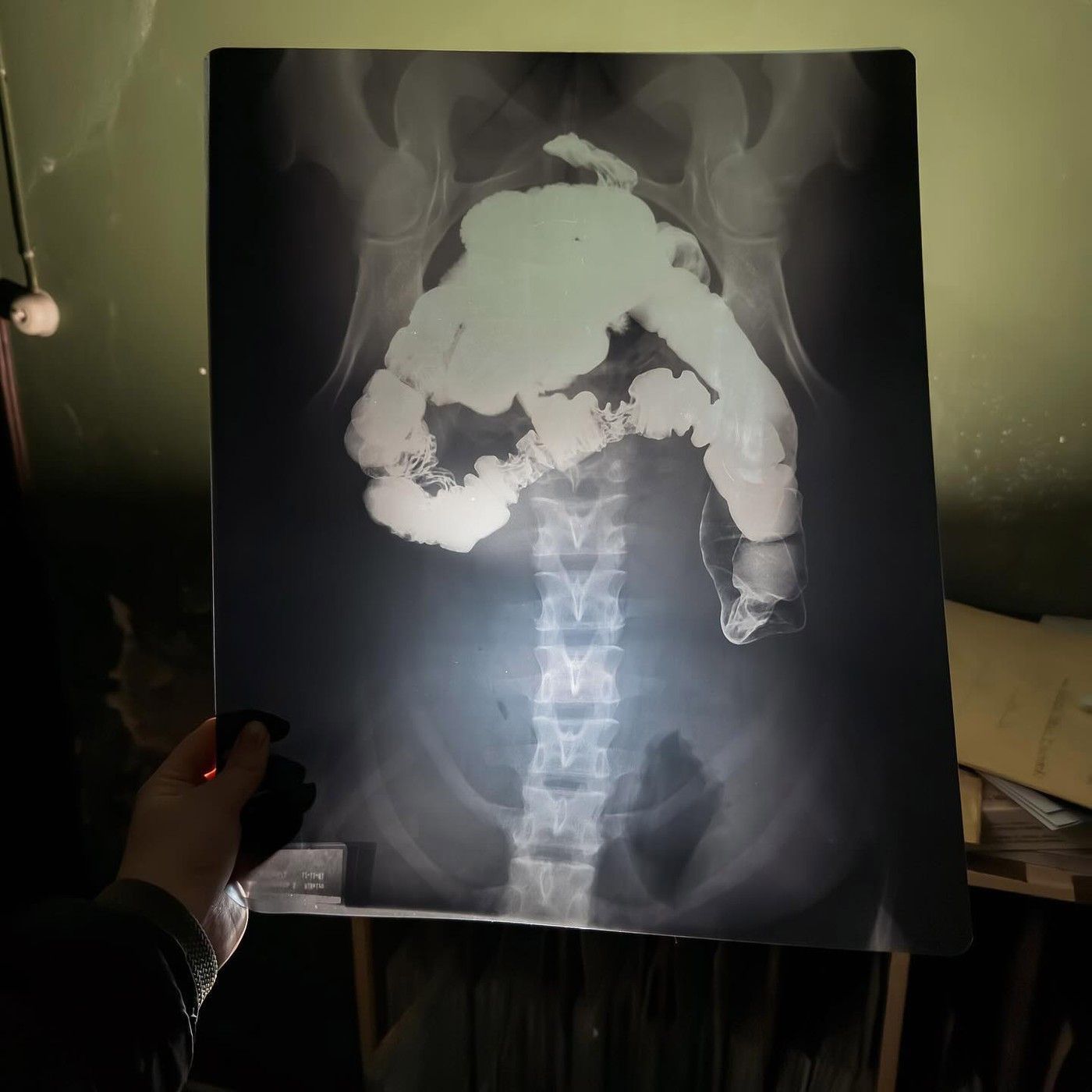 Hororové snímky z dvacet let opuštěné nemocnice