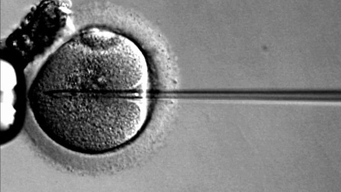 Složitější případ oplození ve zkumavce - vybraná spermie je vnášena mikroinjekcí přímo do vajíčka.