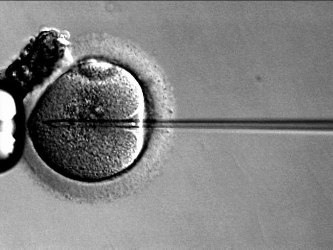 Složitější případ oplození ve zkumavce - vybraná spermie je vnášena mikroinjekcí přímo do vajíčka.