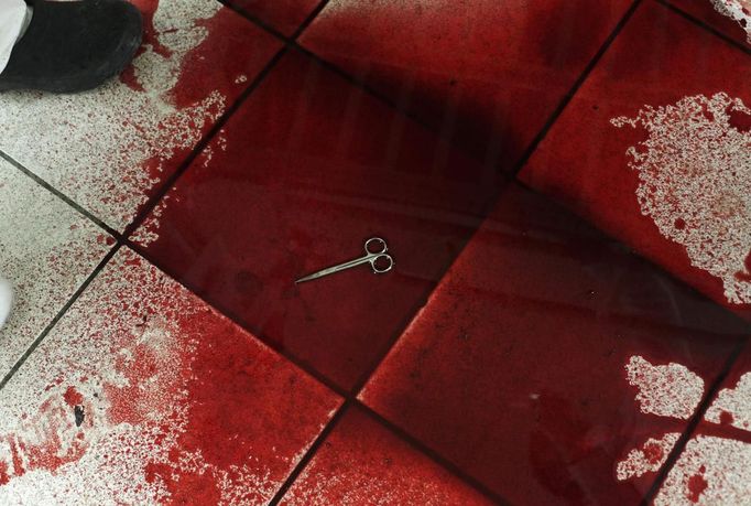 Medical scissors lie in a puddle of blood on the floor of the emergency room at a hospital in San Pedro Sula March 20, 2013.San Pedro Sula, the country's second largest city after Tegucigalpa, has a homicide rate of 169 per 100,000 people and was named the world's most violent city for a second year in a row. Lax laws allow civilians to own up to five personal guns. Arms trafficking has flooded the country with nearly 70% illegal firearms. 83.4% of homicides are by firearms, compared to 60% in the United States. Picture taken March 20, 2013. REUTERS/Jorge Cabrera (HONDURAS - Tags: CRIME LAW CIVIL UNREST HEALTH) ATTENTION EDITORS: PICTURE 25 OF 39 FOR PACKAGE 'GUN CULTURE - HONDURAS' SEARCH 'HONDURAS GUN' FOR ALL IMAGES Published: Dub. 5, 2013, 11:15 dop.