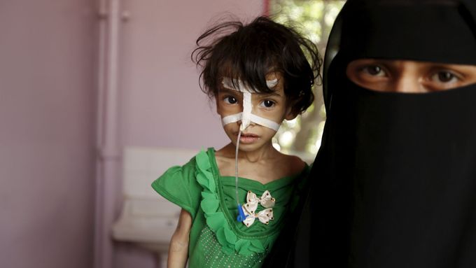 Sedm milionů lidí v Jemenu je na pokraji hladomoru, mezi nejzranitelnější patří malé děti.