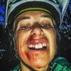 Andrea Hlaváčková bourala na kole