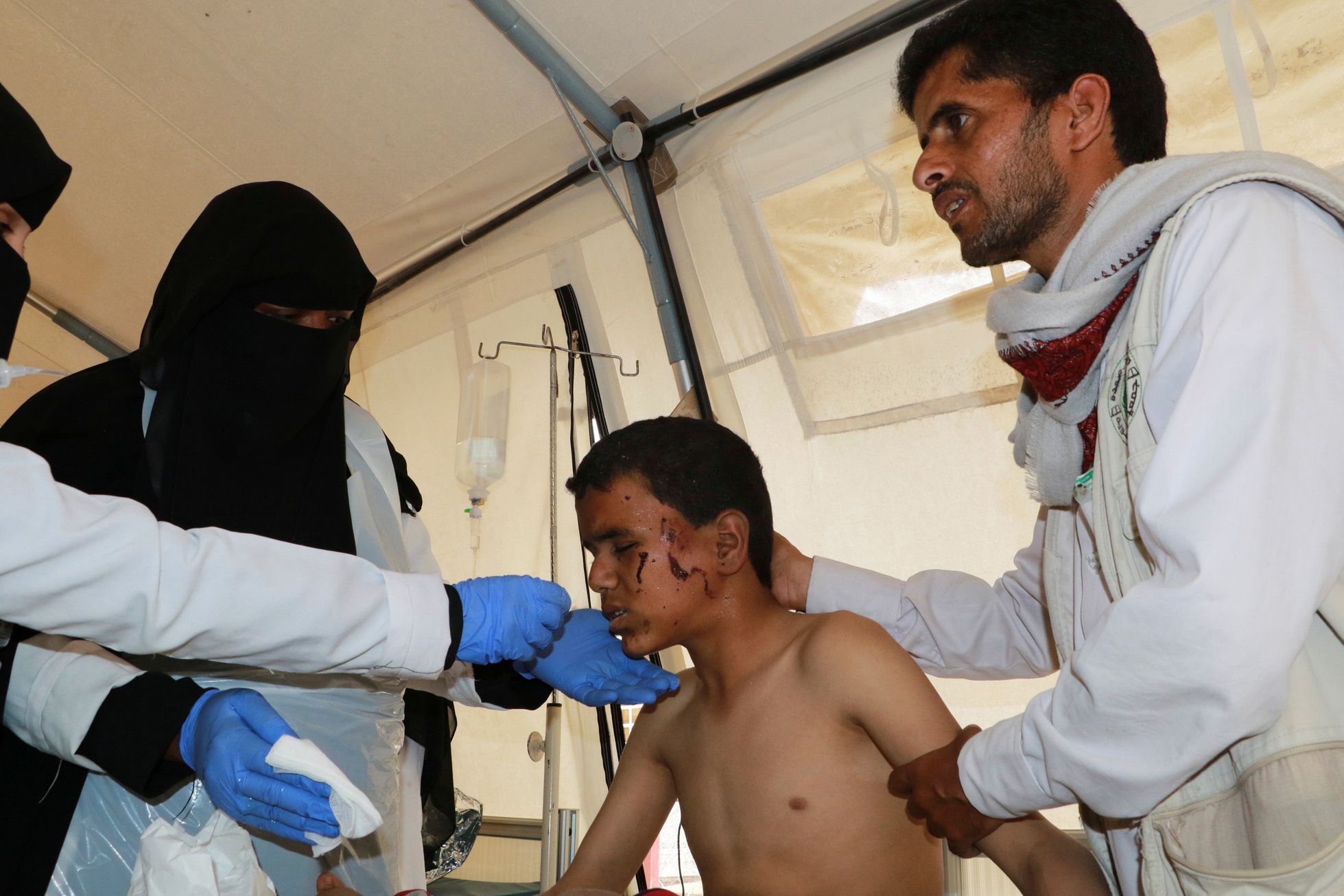 Lékaři ošetřují jemenského chlapce, kterého zasáhly nálety.