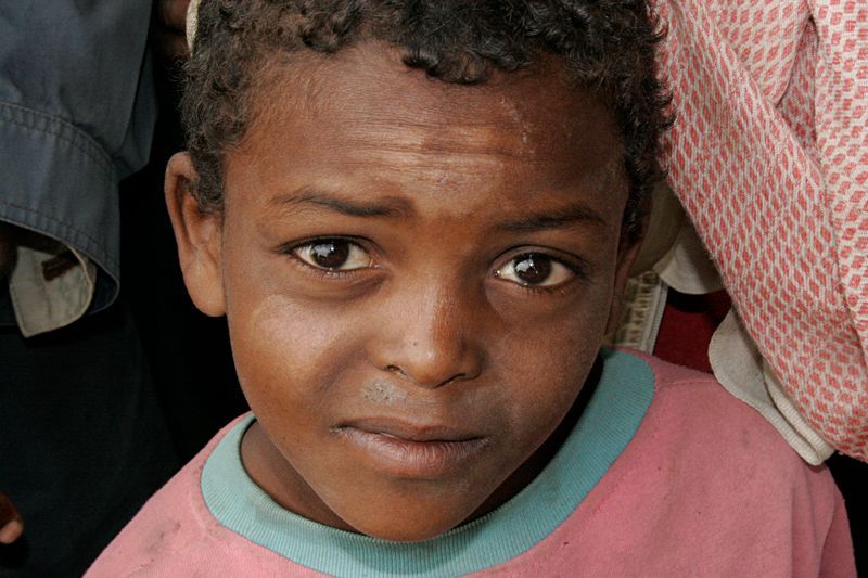 Etiopie-klinika