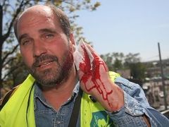 Reportéra Lubomíra Kotka zranila policie výbuškou, které během zásahu nešetrně házela mezi demonstranty.