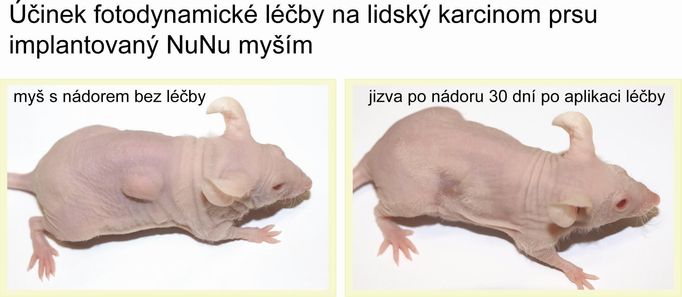 Myš s implantovaným lidským nádorem: po nasazení nové léčby nádor zmizel.