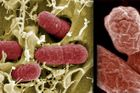 Vědci netuší, jak se bakterie EHEC šíří po Evropě